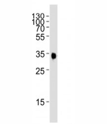 EPHB2 Antibody