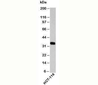 EpCAM Antibody