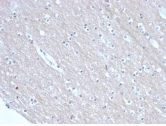 IHC staining of FFPE human brain tissue with SATB2 antibody (clone rSATB2/6929) at 2ug/ml in PBS for