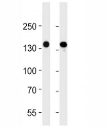 VEGFR3 antibody western blot analysis in 293 and A549 lysate. Predicted molecular weight ~153 kDa (l