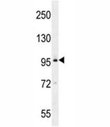 BRDT Antibody