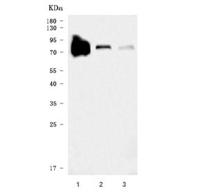 Western blot testing of 1) human HCCP, 2) rat liver and 3) mouse liver tissue lysate with Transferri