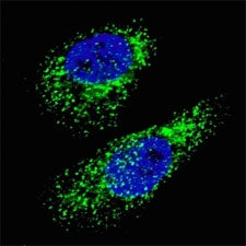 LC3A Antibody (MAP1LC3A)