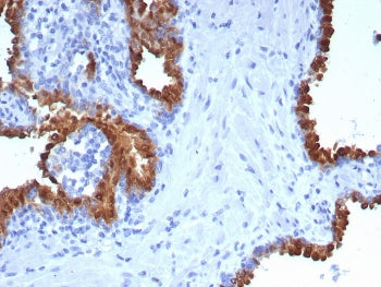 IHC staining of FFPE human prostate tissue with PTPRU antibody (clone PTPRU/7616). HIER: boil tissue