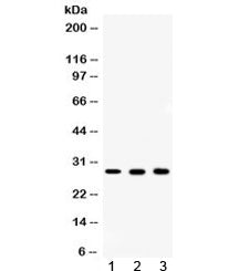 Western blot testing of 1) rat ovary, 2) mouse liver and 3) human MCF7 lysate with CA2 antibody at 0.5ug/m. Predicted/observed molecular weight ~29 kDa.