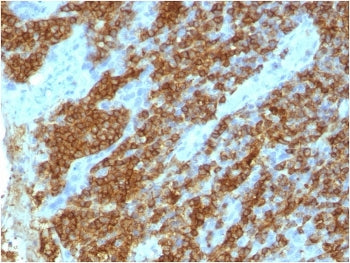 IHC staining of FFPE human tonsil tissue with CD45RA antibody (clone 111-1C5). HIER: boil tissue sec