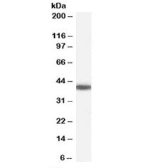 GALR2 Antibody