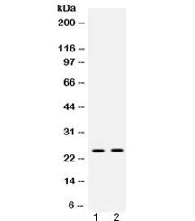 Western blot testing of 1) rat liver and 2) human placenta lysate with HMGB2 antibody at 0.5ug/ml. E