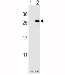 EIF4E2 Antibody