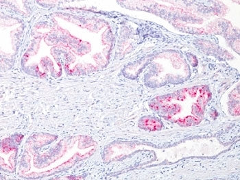 AMACR / p504S Antibody (Prostate Cancer Marker)