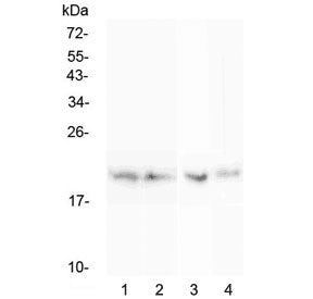 Western blot testing of rat 1) spleen, 2) thymus, 3) lung and 4) testis lysate with BCMA antibody at