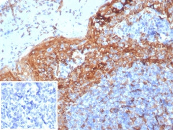 STING1 Antibody / TMEM173