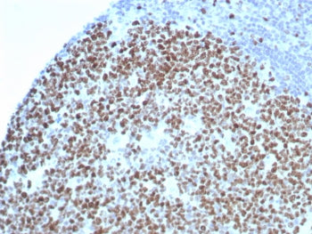 IHC staining of FFPE human tonsil tissue with Ki67 antibody (clone rMKI67/8852). HIER: boil tissue s