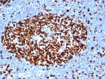 IHC staining of FFPE human tonsil tissue with recombinant Ki-67 antibody (clone MKI67/6517R). HIER: 