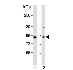 JIP1 Antibody / MAPK8IP1