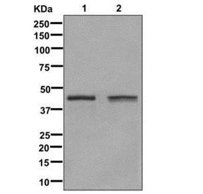 Glutamine Synthetase Antibody / GLUL
