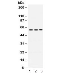 Western blot testing of human 1) A549, 2) 22RV1 and 3) U20S cell lysate with RAG2 antibody. Expected