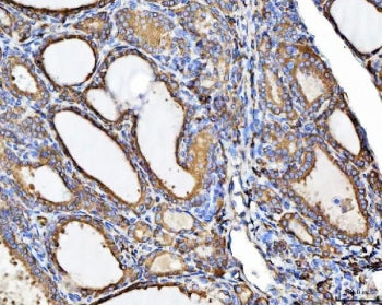 CHM Antibody / Choroideremia protein