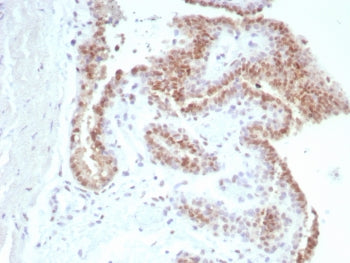 Androgen Receptor Antibody