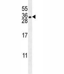 HLA-DQA1 Antibody