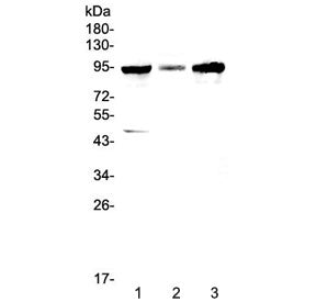 GNS Antibody / Glucosamine (N-acetyl)-6-sulfatase