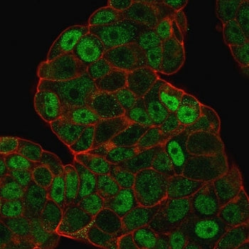 Immunofluorescent staining of PFA fixed human MCF7 cells with p27Kip1 antibody (clone SPM348, green)