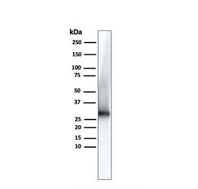Western blot testing of human kidney lysate with Adiponectin antibody. Predicted molecular weigth ~3