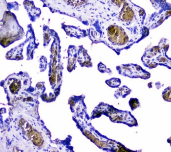 Hemoglobin Antibody (subunit alpha)