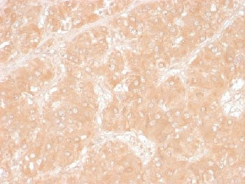 IHC testing of FFPE human adrenal tissue with Perilipin 2 antibody (clone ADFP/1366). Required HIER: