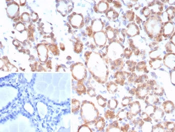 TrkB Antibody / NTRK2