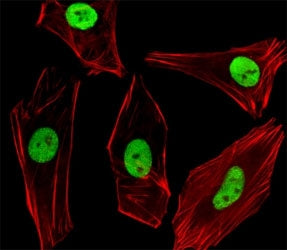 Fluorescent image of SH-SY5Y cells stained with SUMO2/3 antibody diluted at 1:100 dilution. An Alexa