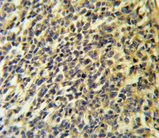 PLA2G6 Antibody / CaI-PLA2