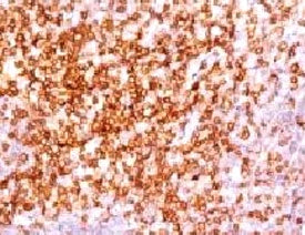 CD6 Antibody