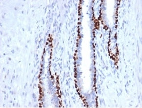 IHC staining of FFPE human prostate tissue with recombinant deltaNp63 antibody (clone P40/4396R). HI
