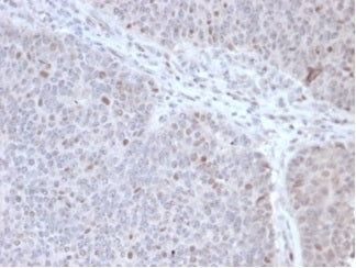 POLE3 Antibody / CHRAC-17