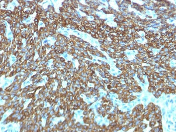 Basic Cytokeratin Antibody