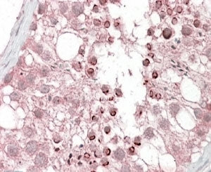 IHC testing of FFPE human testis with USP28 antibody at 4ug/ml. HIER: steamed with pH6 citrate buffe
