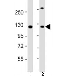 Western blot testing of human 1) A431 and 2) HeLa cell lysate with INTS6 antibody at 1:2000. Predict