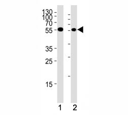 CHK1 Antibody