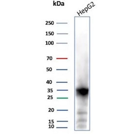 ARK1C1 Antibody / Aldo-keto Reductase Family 1 Member C1