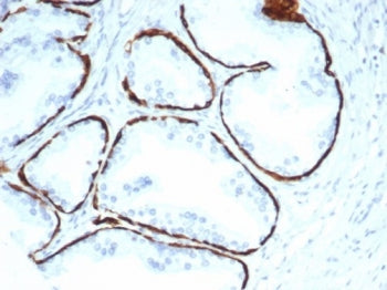 IHC staining of FFPE human prostate tissue with recombinant Cytokeratin 14 antibody (clone KRT14/705