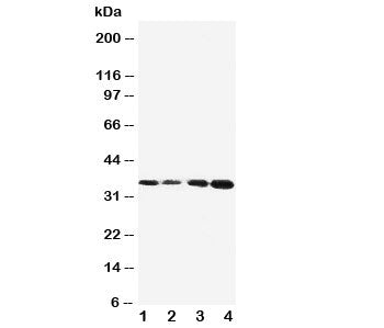 Protein C Antibody