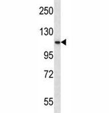 PCSK6 Antibody