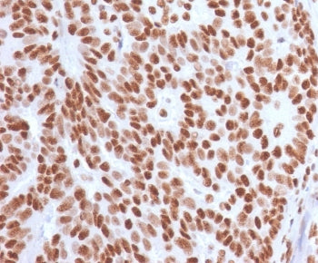 Estrogen Receptor alpha Antibody