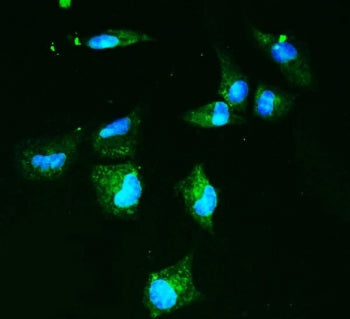 GLUT9 Antibody / Glucose Transporter 9 / SLC2A9