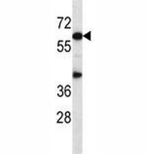 Akt1 Antibody