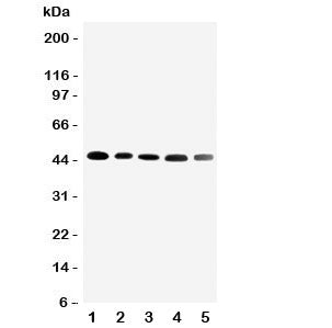 Western blot testing of CBG antibody and Lane 1: HeLa; 2: A431; 3: U87; 4: 22RV1; 5: PANC cell lysat