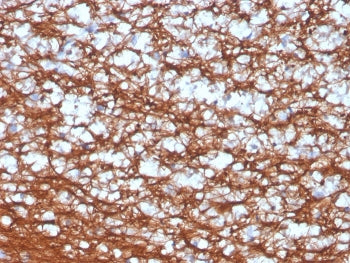 IHC staining of FFPE human cerebellum with recombinant PGP9.5 antibody (clone UCHL1/4556R). HIER: bo