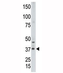 CDX2 Antibody