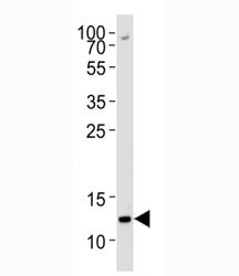 Histone H4 Antibody (Methyl-Lys20 specific)